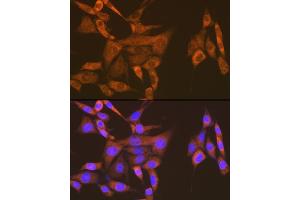 Immunofluorescence analysis of NIH-3T3 cells using USP9X Rabbit mAb (ABIN7271169) at dilution of 1:100 (40x lens). (USP9X 抗体)