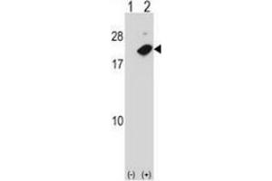 Western blot analysis of NUDT2 (arrow) using NUDT2 / APAH1 Antibody : 293 cell lysates (2 ug/lane) either nontransfected (Lane 1) or transiently transfected (Lane 2) with the NUDT2 gene. (NUDT2 抗体  (Middle Region))