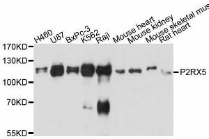 Western blot analysis of extracts of various cell lines, using P2RX5 antibody. (P2RX5 抗体  (AA 341-422))