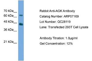 WB Suggested Anti-AGK  Antibody Titration: 0. (Acylglycerol Kinase 抗体  (N-Term))