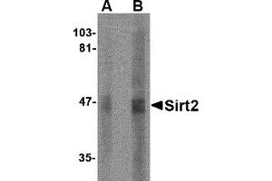 Western Blotting (WB) image for anti-Sirtuin 2 (SIRT2) (N-Term) antibody (ABIN1031568)