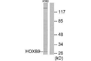 Western blot analysis of extracts from K562 cells, using HOXB9 antibody. (HOXB9 抗体  (Internal Region))