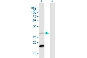 Western Blot analysis of C18orf55 expression in transfected 293T cell line ( H00029090-T01 ) by C18orf55 MaxPab polyclonal antibody.