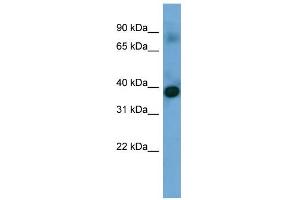 WB Suggested Anti-SFXN4 Antibody Titration: 0. (Sideroflexin 4 抗体  (N-Term))