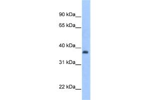 WB Suggested Anti-ST3GAL2 Antibody Titration:  0.