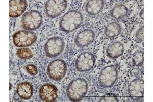Image no. 1 for anti-EPH Receptor B3 (EPHB3) (AA 899-998) antibody (ABIN598667) (EPH Receptor B3 抗体  (AA 899-998))