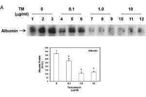 Western Blot of Anti-Human Serum Albumin Antibody. (Albumin 抗体)