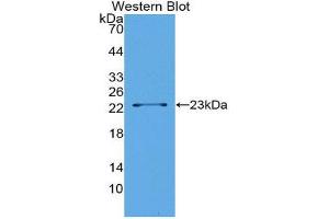 Western Blotting (WB) image for anti-Lipolysis Stimulated Lipoprotein Receptor (LSR) (AA 335-589) antibody (ABIN1176166) (LSR 抗体  (AA 335-589))