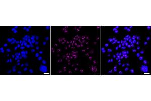Immunocytochemical staining of HAP-1 cells with Nucleolin antibody (ABIN7799667), 1:1,000).