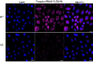 Immunocytochemical staining of HeLa cells using Phospho-PRAS40 (T246) antibody (ABIN7797545), 1:1,000), Top panel: wild-type (WT), Bottom panal: Phospho-PRAS40 (T246) shRNA knockdown (KD).