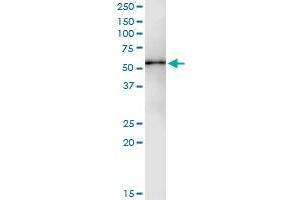 Immunoprecipitation of PPM1F transfected lysate using anti-PPM1F MaxPab rabbit polyclonal antibody and Protein A Magnetic Bead , and immunoblotted with PPM1F purified MaxPab mouse polyclonal antibody (B01P) . (PPM1F 抗体  (AA 1-454))