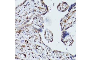 Immunohistochemistry of paraffin-embedded human placenta using PLK1 Rabbit pAb (ABIN3023351, ABIN3023352, ABIN3023353 and ABIN6219645) at dilution of 1:100 (40x lens). (PLK1 抗体  (AA 304-603))