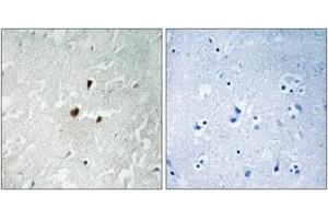 Immunohistochemistry analysis of paraffin-embedded human brain, using TIF-IA (Phospho-Ser649) Antibody. (RRN3 抗体  (pSer649))