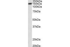 Image no. 1 for anti-ATPase, Ca++ Transporting, Plasma Membrane 1 (ATP2B1) (AA 312-327) antibody (ABIN1100135) (ATP2B1 抗体  (AA 312-327))
