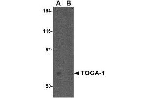 Image no. 1 for anti-Formin Binding Protein 1-Like (FNBP1L) (N-Term) antibody (ABIN1494383) (FNBP1L 抗体  (N-Term))