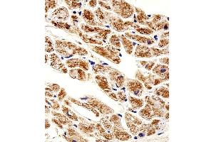 Immunohistochemical analysis of paraffin-embedded H. (ZNF175 抗体  (N-Term))