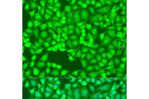 Immunofluorescence analysis of U2OS cells using FLT4 Polyclonal Antibody at dilution of 1:100. (FLT4 抗体)