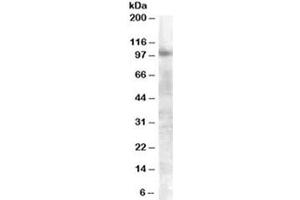 Western blot testing of A549 lysate with FGFR2 antibody at 0. (FGFR2 抗体)