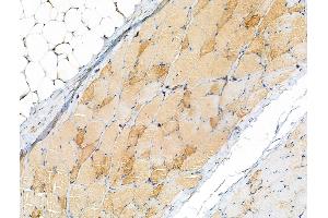 ABIN7093174 and ABIN7101256 at 1/100 staining Rat skin tissue by IHC-P. (C9 抗体)
