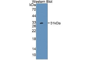 Detection of Recombinant PTPRK, Human using Polyclonal Antibody to Protein Tyrosine Phosphatase Receptor Type K (PTPRK) (PTPRK 抗体  (AA 1185-1440))