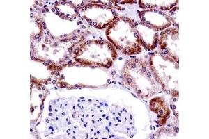 CD70 antibody immunohistochemistry analysis in formalin fixed and paraffin embedded human kidney tissue. (CD70 抗体  (AA 72-101))