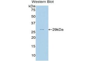 Western Blotting (WB) image for anti-Complement Factor H (CFH) (AA 975-1217) antibody (ABIN3208198) (Complement Factor H 抗体  (AA 975-1217))