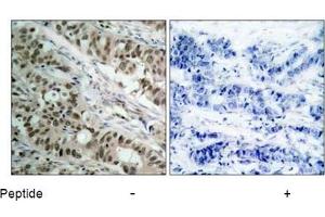 Image no. 3 for anti-Forkhead Box O1 (FOXO1) (AA 254-258) antibody (ABIN197334) (FOXO1 抗体  (AA 254-258))