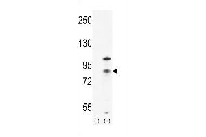 Western blot analysis of CTNB1 (arrow) using rabbit polyclonal CTNB1 Antibody (C-term) (ABIN655178 and ABIN2844795). (CTNNB1 抗体  (C-Term))