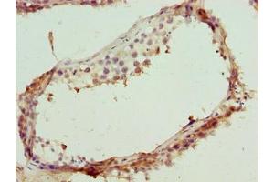 Immunohistochemistry of paraffin-embedded human testis tissue using ABIN7171810 at dilution of 1:100 (TEX35 抗体  (AA 1-215))