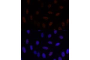 Immunofluorescence analysis of U-2 OS cells using GLI2 antibody (ABIN7267384) at dilution of 1:100. (GLI2 抗体)