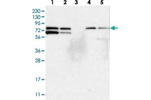 Western blot analysis of Lane 1: RT-4, Lane 2: U-251 MG, Lane 3: Human Plasma, Lane 4: Liver, Lane 5: Tonsil with SNX18 polyclonal antibody  at 1:250-1:500 dilution.