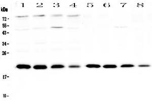 Western blot analysis of BNIP3 using anti-BNIP3 antibody . (BNIP3 抗体)