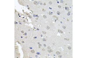 Immunohistochemistry of paraffin-embedded mouse brain using PKN1 antibody (ABIN6003498) at dilution of 1/100 (40x lens).
