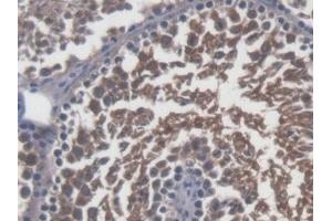 Detection of Sp17 in Mouse Testis Tissue using Polyclonal Antibody to Sperm Protein 17 (Sp17) (SPA17 抗体  (AA 1-149))