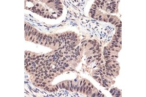 Immunohistochemistry of paraffin-embedded human colon carcinoma using EHMT2 Rabbit mAb (ABIN7265616) at dilution of 1:100 (40x lens). (EHMT2 抗体)