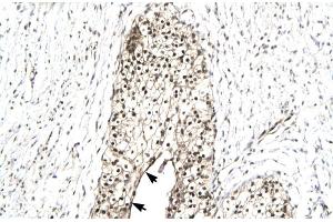 Immunohistochemistry (IHC) image for anti-RuvB-Like 2 (E. Coli) (RUVBL2) (N-Term) antibody (ABIN2779600)