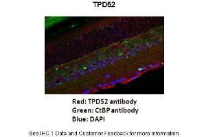 Application: Immunofluorescence Species+tissue/cell type: Mouse retina Primary antibody dilution: 1:200 Secondary antibody: Goat anti-rabbit Alexafluor 568 Secondary antibody dilution: 1:200 - See more at: (TPD52 抗体  (Middle Region))