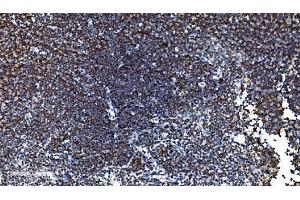 IHC analysis of CDC45L using anti-CDC45L antibody (ABIN7600230).