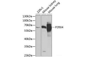Western blot analysis of extracts of various cell lines using P2RX4 Polyclonal Antibody at dilution of 1:1000. (P2RX4 抗体)