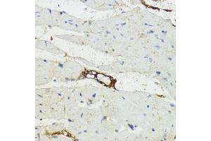 Immunohistochemistry (IHC) image for anti-Complement Factor B (CFB) (AA 80-420) antibody (ABIN3015550)