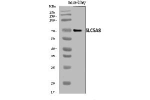Western blot analysis of SLC5A8 using anti-SLC5A8 antibody (ABIN7601286).