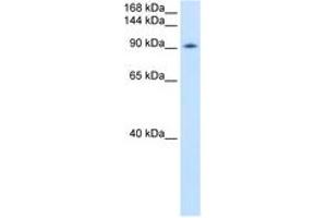 Image no. 1 for anti-DEAD (Asp-Glu-Ala-Asp) Box Polypeptide 54 (DDX54) (AA 661-710) antibody (ABIN6736604) (DDX54 抗体  (AA 661-710))