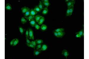 Immunofluorescence staining of HepG2 cells with ABIN7159817 at 1:100, counter-stained with DAPI. (OGN 抗体  (AA 21-298))