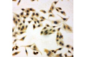 ICC testing of NRG1 antibody and HeLa cells (Neuregulin 1 抗体  (C-Term))