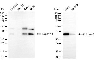 Western blotting analysis using calponin 1 antibody (ABIN7797851).