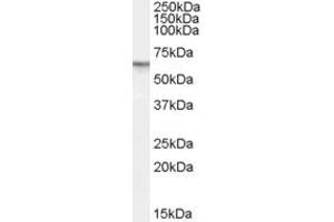 ABIN195735 (1µg/ml) staining of Human Prostate lysate (35µg protein in RIPA buffer). (PDE11A 抗体  (Internal Region))