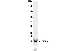 anti-Fatty Acid Binding Protein 3, Muscle and Heart (FABP3) antibody
