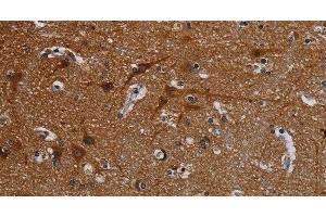 Immunohistochemistry of paraffin-embedded Human brain tissue using PCDHB15 Polyclonal Antibody at dilution 1:50 (PCDHB15 抗体)