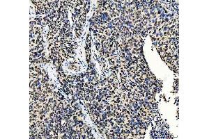 IHC analysis of MTA2 using anti-MTA2 antibody (ABIN7599519). (MTA2 抗体  (AA 1-668))