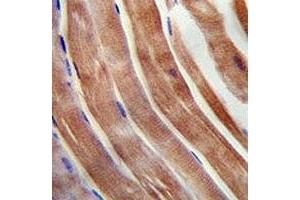 KEAP1 antibody immunohistochemistry analysis in formalin fixed and paraffin embedded human skeletal muscle. (KEAP1 抗体  (AA 422-449))